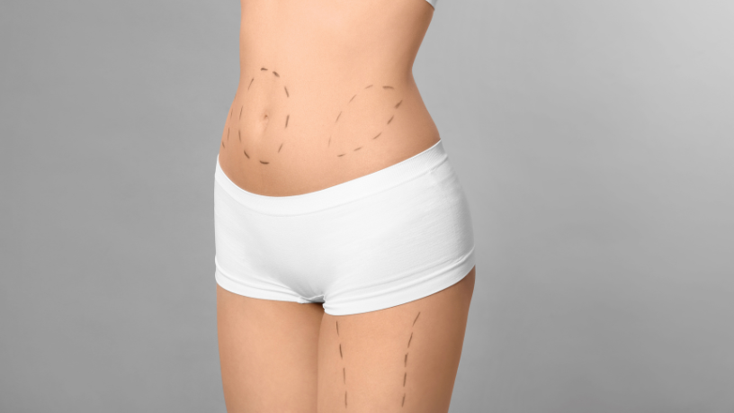 Entenda com Milton Seigi Hayashi qual técnica é mais indicada para o seu objetivo estético e perfil físico.